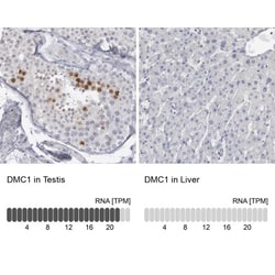 DMC1 Antibody, Novus Biologicals:Antibodies:Primary Antibodies